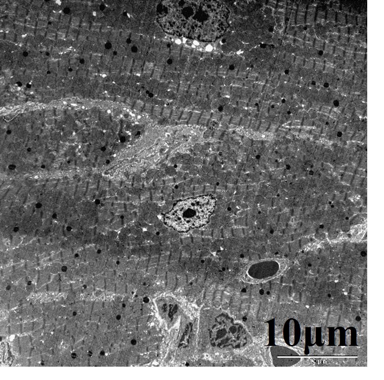 Mouse heart tissue.