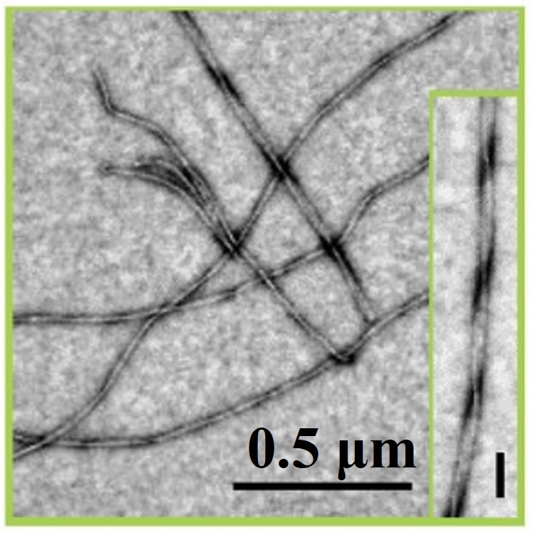 Negatively stained amyloid fibril.